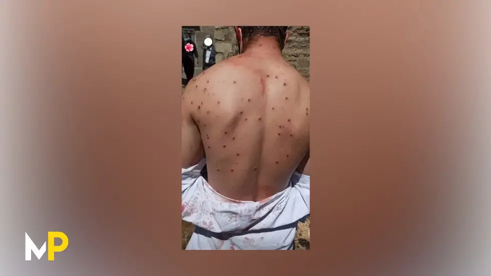 Mass Protests, Morality Police, and Iranian Bravery | King Raam 162 043